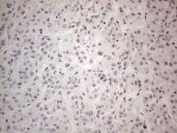 NR2C2 Monoclonal Antibody (OTI2H2), TrueMAB , OriGene:Antibodies:Primary