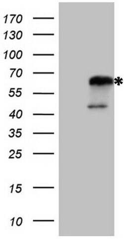 NR2C2 Mouse anti-Human, Clone: OTI1F3, lyophilized, TrueMAB 100 &mu;g;