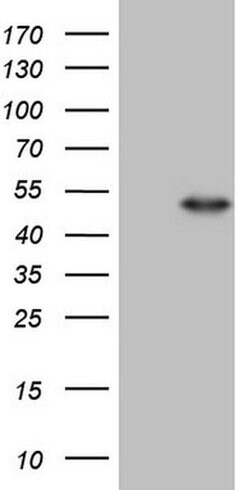 NR2E3 Monoclonal Antibody (OTI3D4), TrueMAB , OriGene 100 &mu;L; Unconjugated:Antibodies,