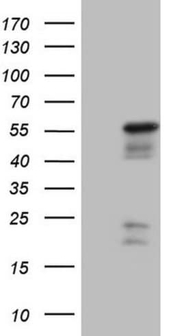 NR2E3 Monoclonal Antibody (OTI2F6), TrueMAB , OriGene:Antibodies:Primary