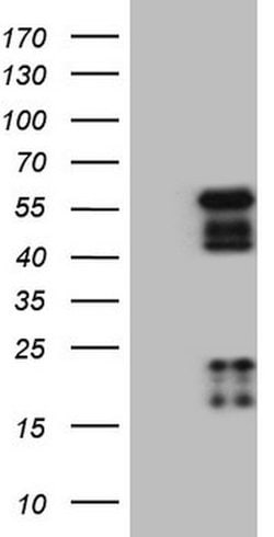 NR2E3 Mouse anti-Human, Clone: OTI3G3, lyophilized, TrueMAB 100 &mu;g;