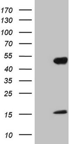NR2E3 Monoclonal Antibody (OTI2G3), TrueMAB , OriGene 100 &mu;L; Unconjugated:Antibodies,