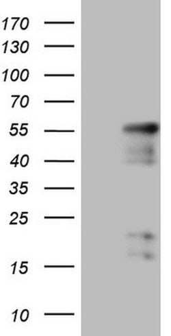 NR2E3 Mouse anti-Human, Clone: OTI3D9, lyophilized, TrueMAB 100 &mu;g;