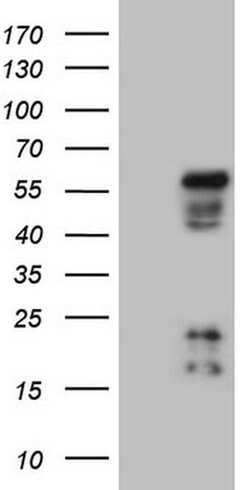 NR2E3 Monoclonal Antibody (OTI2H9), TrueMAB , OriGene 100 &mu;L; Unconjugated:Antibodies,