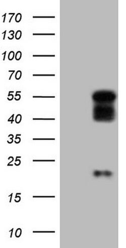 NR2E3 Monoclonal Antibody (OTI4H7), TrueMAB , OriGene 30 &mu;L; Unconjugated:Antibodies,