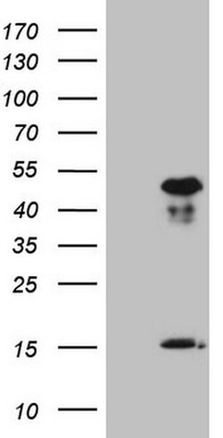 NR2E3 Monoclonal Antibody (OTI1F4), TrueMAB , OriGene 100 &mu;L; Unconjugated:Antibodies,