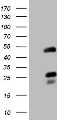 NR2F6 Monoclonal Antibody (OTI2C9), TrueMAB , OriGene 30 &mu;L; Unconjugated:Antibodies,