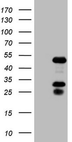 NR2F6 Monoclonal Antibody (OTI2H4), TrueMAB , OriGene 100 &mu;L; Unconjugated:Antibodies,