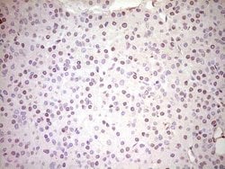 NR3C1 Mouse anti-Human, Clone: OTI4C9, lyophilized, TrueMAB 100 &mu;g;