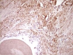 NR3C1 Mouse anti-Human, Clone: OTI4C9, lyophilized, TrueMAB 100 &mu;g;
