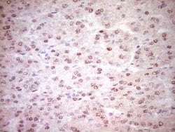NR3C1 Mouse anti-Human, Clone: OTI4C9, lyophilized, TrueMAB 100 &mu;g;