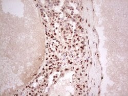 NR3C1 Monoclonal Antibody (OTI3F1), TrueMAB , OriGene 100 &mu;L; Unconjugated:Antibodies,