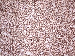 NR3C1 Monoclonal Antibody (OTI3F1), TrueMAB , OriGene 100 &mu;L; Unconjugated:Antibodies,