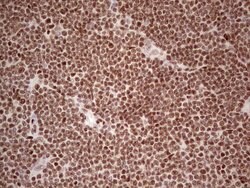 NR3C1 Monoclonal Antibody (OTI6B5), TrueMAB , OriGene 30 &mu;L | Buy Online | Origene Technologies | Fisher Scientific