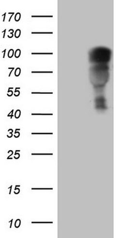 NR3C1 Monoclonal Antibody (OTI2C4), TrueMAB , OriGene 100 &mu;L; Unconjugated:Antibodies,