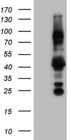 NR3C1 Mouse anti-Human, Clone: OTI2E12, lyophilized, TrueMAB 100 &mu;g;