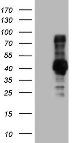 NR3C1 Monoclonal Antibody (OTI1B11), TrueMAB , OriGene:Antibodies:Primary