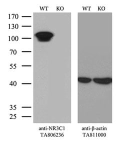 NR3C1 Monoclonal Antibody (OTI3F1), TrueMAB , OriGene 100 &mu;L; Unconjugated:Antibodies,