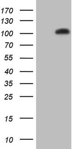 NR3C1 Monoclonal Antibody (OTI6B5), TrueMAB , OriGene 30 &mu;L | Buy Online | Origene Technologies | Fisher Scientific