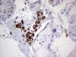 NR4A3 Mouse anti-Human, Clone: OTI2E1, lyophilized, TrueMAB 100 &mu;g;
