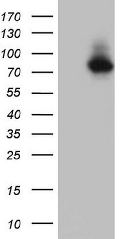 NR4A3 Mouse anti-Human, Clone: OTI2E1, lyophilized, TrueMAB 100 &mu;g;