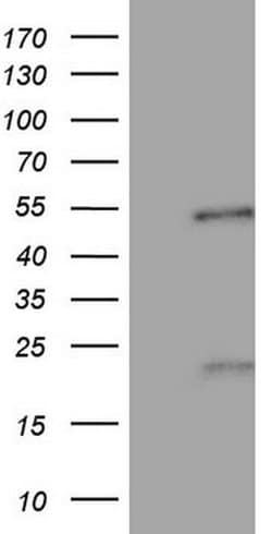 NR5A1 Monoclonal Antibody (OTI1F2), TrueMAB , OriGene 30 &mu;L | Buy Online | Origene Technologies | Fisher Scientific