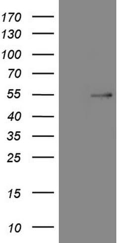 NR5A1 Mouse anti-Human, Clone: OTI1D2, lyophilized, TrueMAB 100 &mu;g;