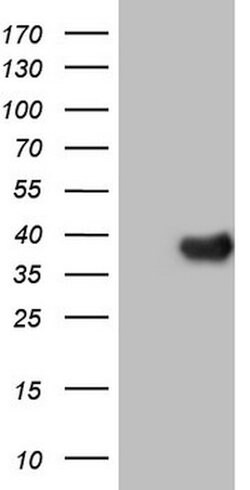 NR5A2 Mouse anti-Human, Clone: OTI3H8, lyophilized, TrueMAB 100 &mu;g;