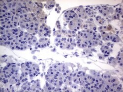 NRBF2 Monoclonal Antibody (OTI1C1), TrueMAB , OriGene:Antibodies:Primary