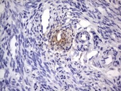 NRBF2 Mouse anti-Human, Clone: OTI1C1, lyophilized, TrueMAB 100 &mu;g | Buy Online | Origene Technologies | Fisher Scientific