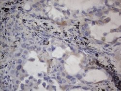 NRBF2 Monoclonal Antibody (OTI1C4), TrueMAB , OriGene 100 &mu;L | Buy Online | OriGene | Fisher Scientific