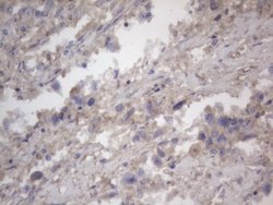 NRBF2 Monoclonal Antibody (OTI1C4), TrueMAB , OriGene 100 &mu;L | Buy Online | OriGene | Fisher Scientific