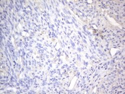 NRBF2 Monoclonal Antibody (OTI1C4), TrueMAB , OriGene 100 &mu;L | Buy Online | OriGene | Fisher Scientific