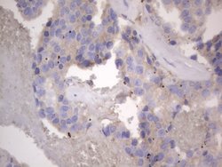 NRBF2 Monoclonal Antibody (OTI1C4), TrueMAB , OriGene 100 &mu;L | Buy Online | OriGene | Fisher Scientific