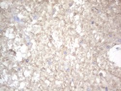 NRBF2 Monoclonal Antibody (OTI1C4), TrueMAB , OriGene 100 &mu;L | Buy Online | OriGene | Fisher Scientific