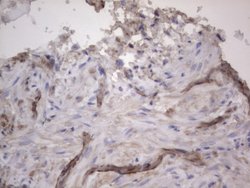 NRBF2 Monoclonal Antibody (OTI1C4), TrueMAB , OriGene 100 &mu;L | Buy Online | OriGene | Fisher Scientific