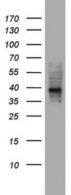 NRBF2 Monoclonal Antibody (OTI1C1), TrueMAB , OriGene 100 &mu;L; Unconjugated:Antibodies,