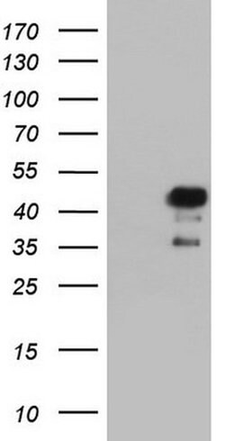 NRBF2 Monoclonal Antibody (OTI1C4), TrueMAB , OriGene 100 &mu;L | Buy Online | OriGene | Fisher Scientific