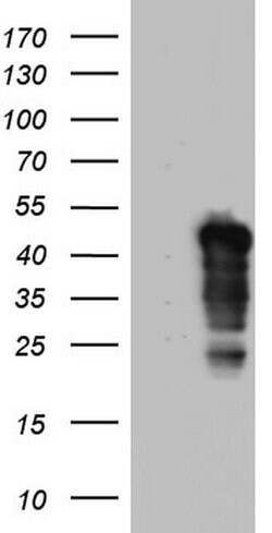 NRBF2 Monoclonal Antibody (OTI1D1), TrueMAB , OriGene 100 &mu;L; Unconjugated:Antibodies,