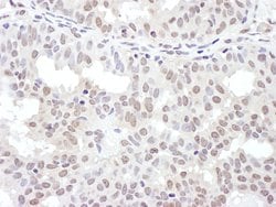 NRF Rabbit anti-Human, Polyclonal, Bethyl Laboratories 100 &mu;L; Unconjugated:Antibodies,
