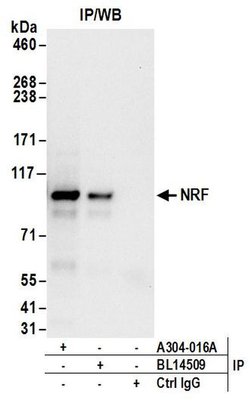 NRF Rabbit anti-Human, Polyclonal, Bethyl Laboratories 100 &mu;L; Unconjugated:Antibodies,