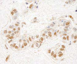 NSD1 Polyclonal Antibody, Bethyl Laboratories:Antibodies:Primary Antibodies