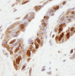 NSD1 Polyclonal Antibody, Bethyl Laboratories 100 &mu;L; Unconjugated:Antibodies,