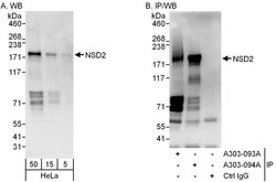 NSD2 Rabbit anti-Human, Polyclonal, Bethyl Laboratories 100 &mu;L; Unconjugated:Antibodies,