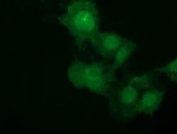 NSMCE2 Monoclonal Antibody (OTI4H9), TrueMAB , OriGene 100 &mu;L; Unconjugated:Antibodies,