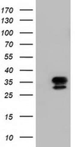 NSMCE2 Monoclonal Antibody (OTI4H9), TrueMAB , OriGene 100 &mu;L; Unconjugated:Antibodies,