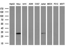 NSMCE2 Monoclonal Antibody (OTI4H9), TrueMAB , OriGene 100 &mu;L; Unconjugated:Antibodies,