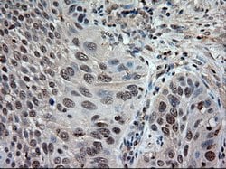 NT3 Mouse anti-Human, Clone: OTI5A2, lyophilized, TrueMAB 100 &mu;g; Unconjugated:Antibodies,
