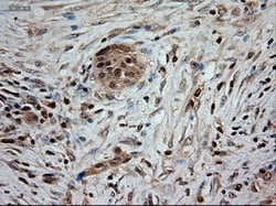 NT3 Mouse anti-Human, Clone: OTI5A2, lyophilized, TrueMAB 100 &mu;g; Unconjugated:Antibodies,