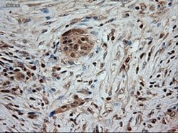 NT3 Mouse anti-Human, Clone: OTI5A2, liquid, TrueMAB 100 &mu;L; Unconjugated:Antibodies,